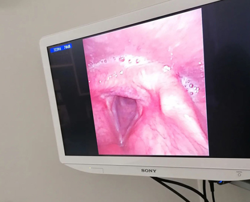 Visite Mediche Foniatriche | Una Voce Sana è Bella